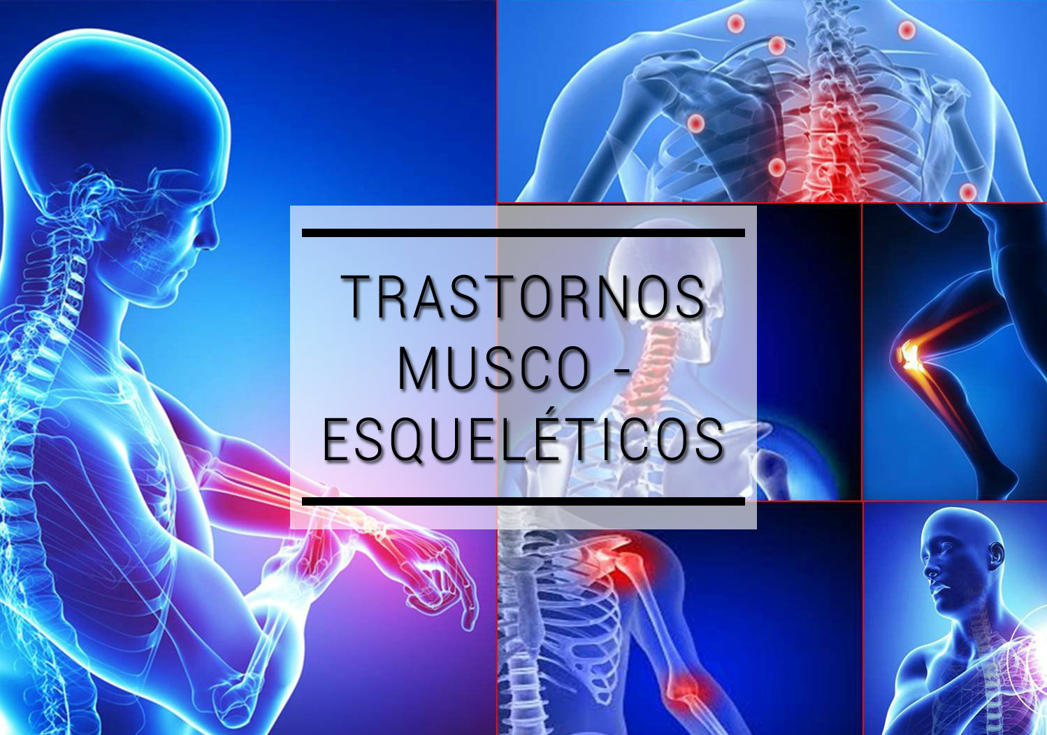 Ppt Trastornos Musculo Esqueleticos De Origen Laboral 3169